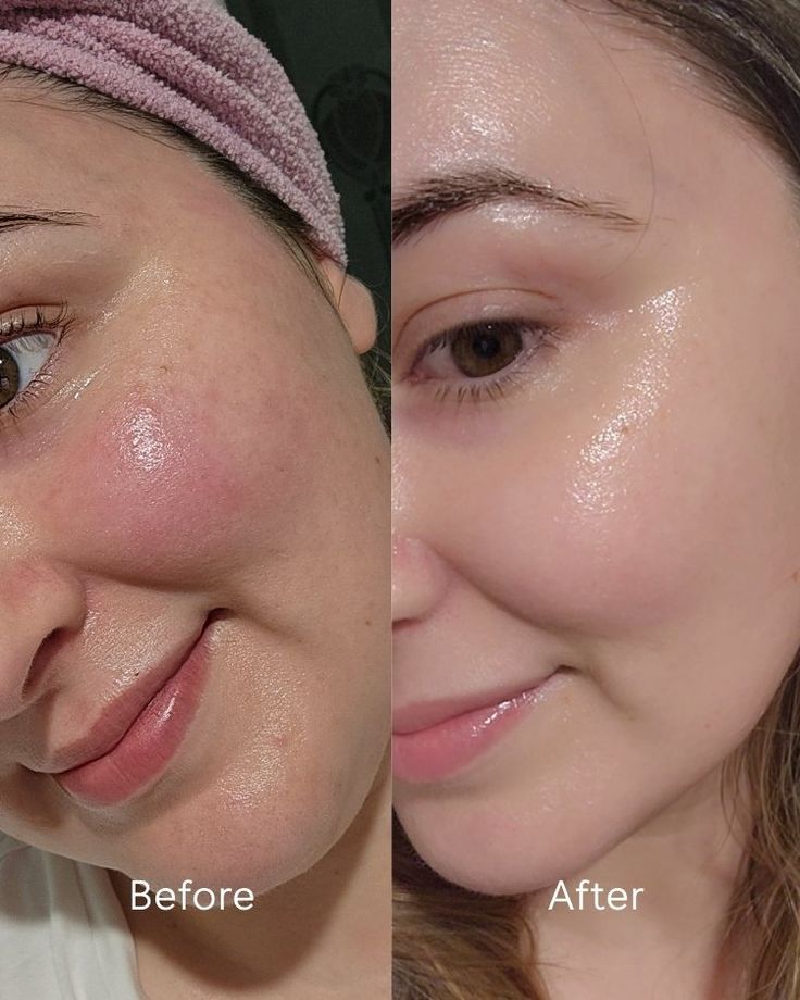 Vaura Vision™ | 7-Colour LED Light Face Mask